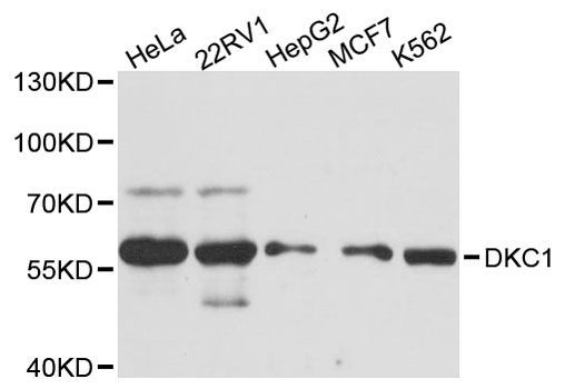 Western blot - DKC1 Polyclonal Antibody (144-12914)