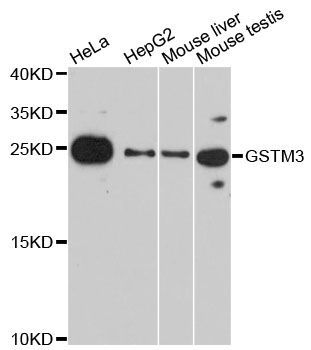 Western blot - GSTM3 Polyclonal Antibody (144-07679)