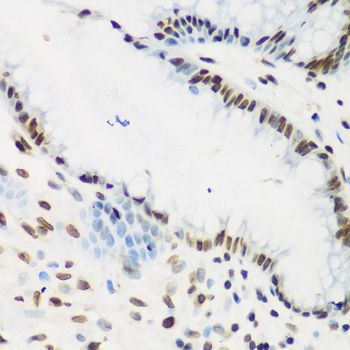 Immunohistochemistry - KLF4 antibody (144-06640)