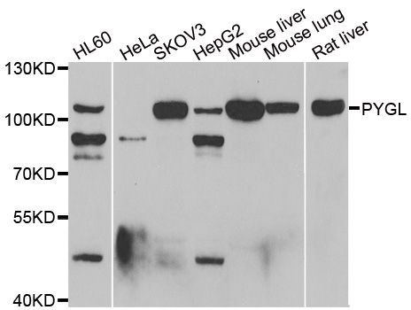 Western blot - PYGL antibody (144-06710)