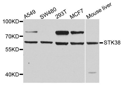 Western blot - STK38 antibody (144-08191)