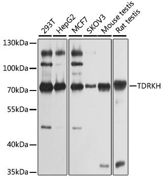 Western blot - TDRKH antibody (144-06767)