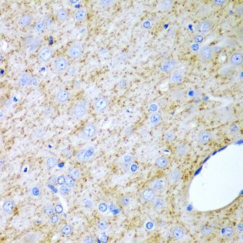 Immunohistochemistry - INHA Polyclonal Antibody (144-01734)