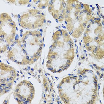 Immunohistochemistry - MRPL1 Polyclonal Antibody (144-04947)