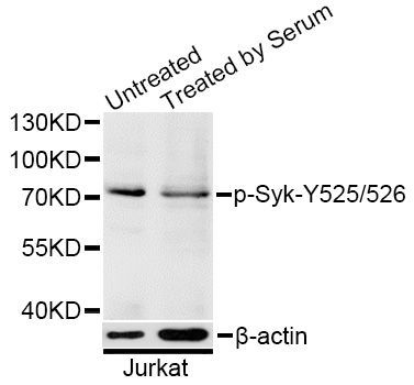 Western blot - Phospho-Syk-Y525/526 pAb (144-50542)