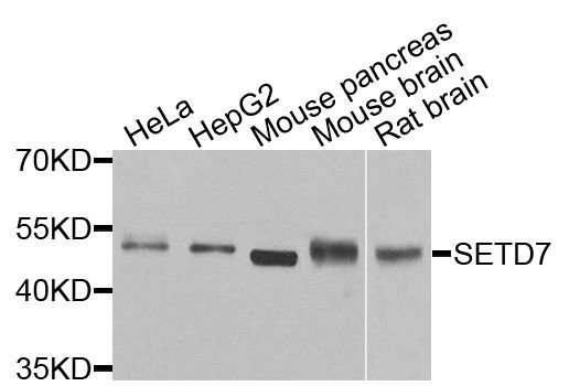 Western blot - [KO Validated] SETD7 Polyclonal Antibody (144-09985)