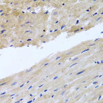 Immunohistochemistry - RAB24 Polyclonal Antibody (144-08394)