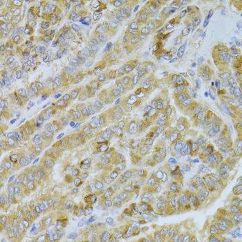 Immunohistochemistry - DLD Antibody (144-05403)