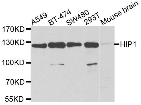 Western blot - HIP1 Polyclonal Antibody (144-06921)