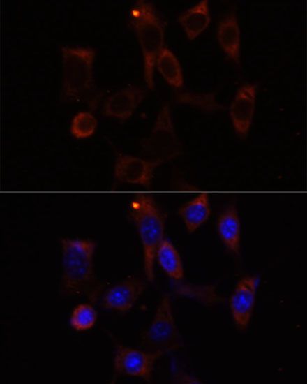 Immunofluorescence - YTHDC2 antibody (144-60880)