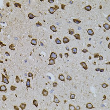 Immunohistochemistry - IRF1 Polyclonal Antibody (144-07692)