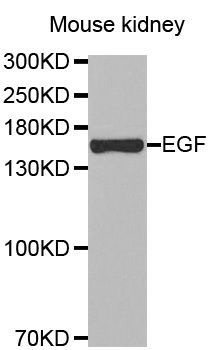 Western blot - EGF antibody (144-02720)
