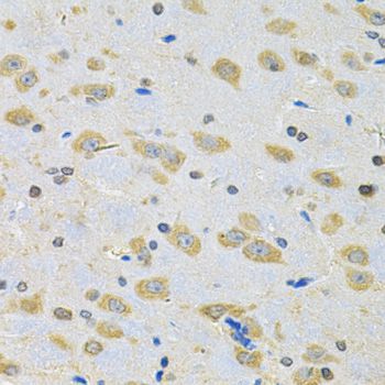Immunohistochemistry - BNIP1 Antibody (144-07263)