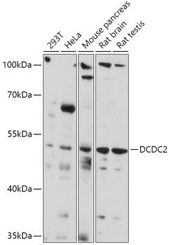 Western blot