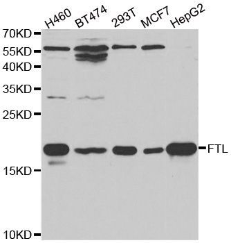 Western blot - FTL antibody (144-01768)
