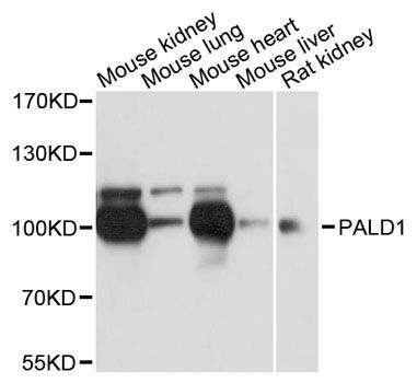Western blot - PALD1 antibody (144-12893)