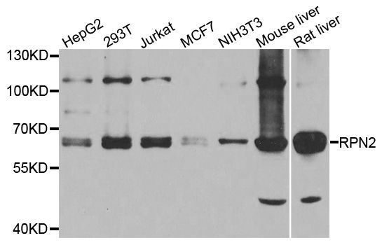 Western blot - RPN2 antibody (144-08352)