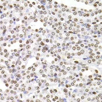 Immunohistochemistry - SOX5 Polyclonal Antibody (144-06985)