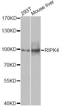 Western blot - RIPK4 Polyclonal Antibody (144-08495)
