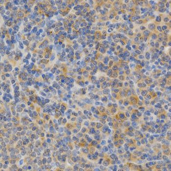 Immunohistochemistry - PRKCE antibody (144-02110)