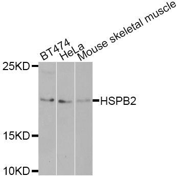 Western blot - HSPB2 antibody (144-02350)