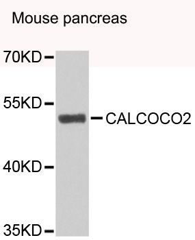 Western blot - CALCOCO2 antibody (144-07358)