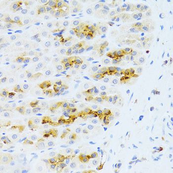 Immunohistochemistry - CHIA Antibody (144-06558)