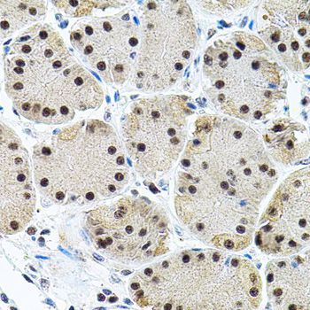 Immunohistochemistry - EIF4G2 antibody (144-02897)