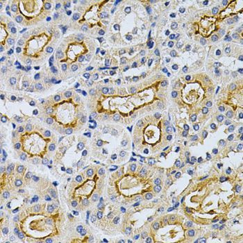 Immunohistochemistry - [KO Validated] ADRBK1 Polyclonal Antibody (144-01662)