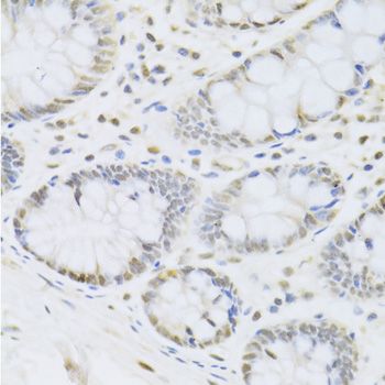 Immunohistochemistry - CBX8 Polyclonal Antibody (144-06222)
