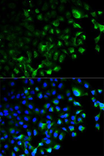 Western blot - [KO Validated] TRAF2 Polyclonal Antibody (144-00962)