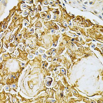 Immunohistochemistry - [KO Validated] ADRBK1 Polyclonal Antibody (144-01662)