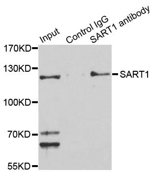 Immunoprecipitation - SART1 Polyclonal Antibody (144-08569)