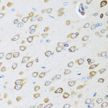 Immunohistochemistry - OGN antibody (144-06679)