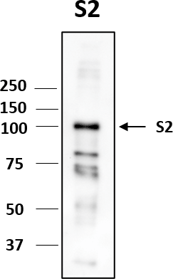 Western blot image