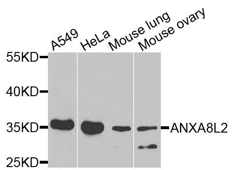 Western blot - ANXA8L2 antibody (144-07641)