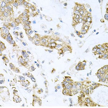 Immunohistochemistry - ALKBH8 antibody (144-07142)