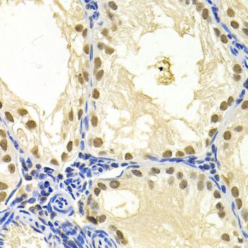Immunohistochemistry - DDB1 Polyclonal Antibody (144-02896)