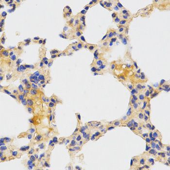 Immunohistochemistry - ATG3 antibody (144-05809)