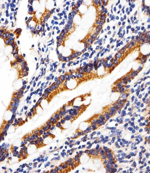 IHC-P
