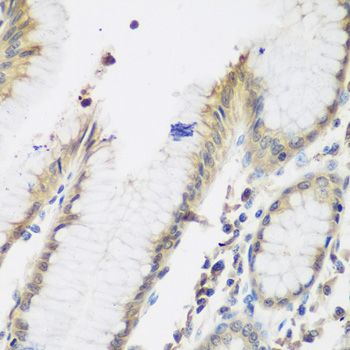 Immunohistochemistry - NAA50 antibody (144-61406)