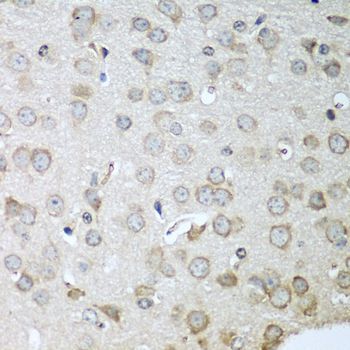 Immunohistochemistry - CDH11 Polyclonal Antibody (144-08110)