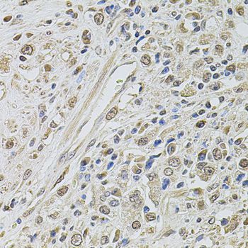 Immunohistochemistry - SMARCC2 antibody (144-01967)