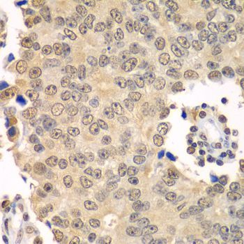 Immunohistochemistry - HDAC2 Polyclonal Antibody (144-02084)
