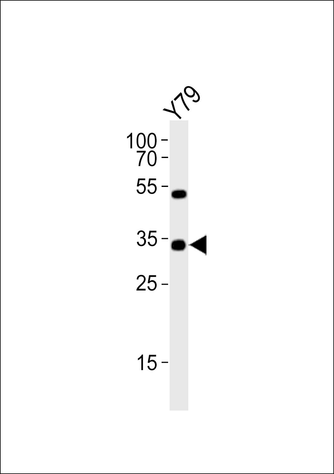 WB