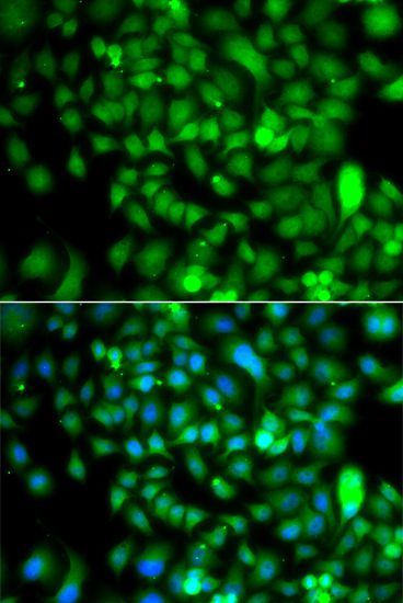 Immunofluorescence - CSRP2BP antibody (144-07380)
