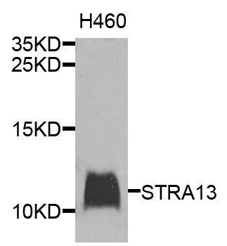 Western blot - STRA13 Polyclonal Antibody (144-09892)