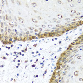 Immunohistochemistry - BMP5 Polyclonal Antibody (144-08401)