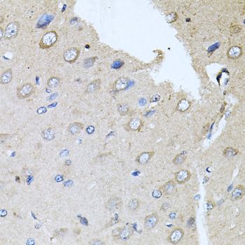 Immunohistochemistry - RARA Polyclonal Antibody (144-00370)