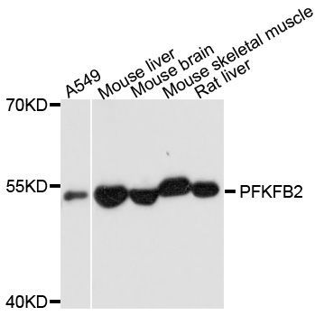 Western blot - PFKFB2 antibody (144-09311)
